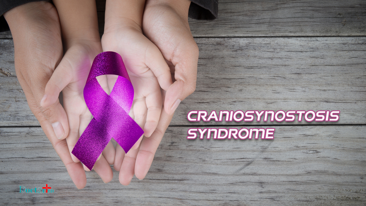 Everything About Craniosynostosis Syndrome
