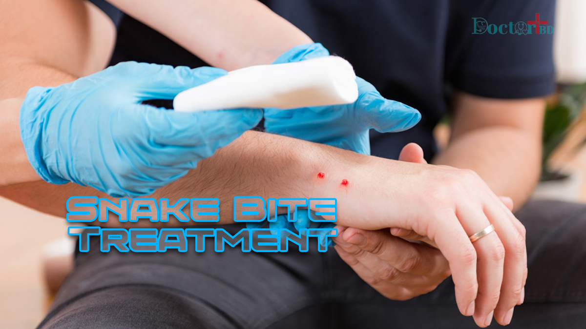 Snake Bite Treatment Protocol: Treating In A Professional Way