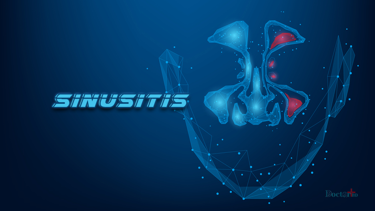 Symptoms, Causes, And Treatment Of Sinusitis: Sinus Infection Symptoms